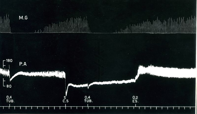 Azione del C.5 sulla tubocurarina