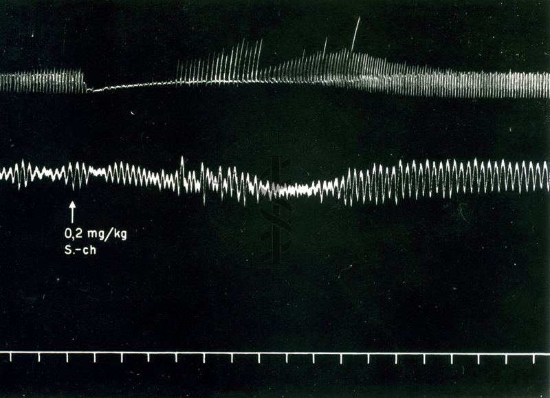 Tracciato dell'effetto della succinilcolina sul respiro del cane