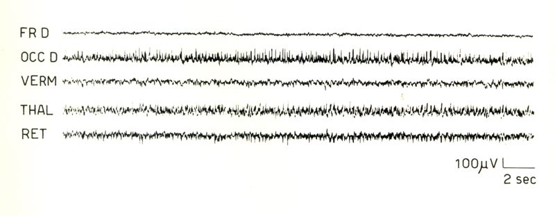 Elettroencefalogrammi di coniglio