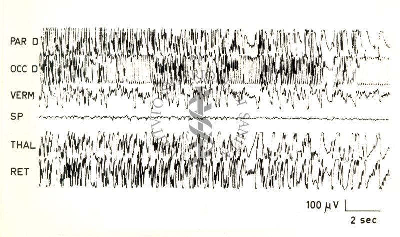 Elettroencefalogrammi di coniglio