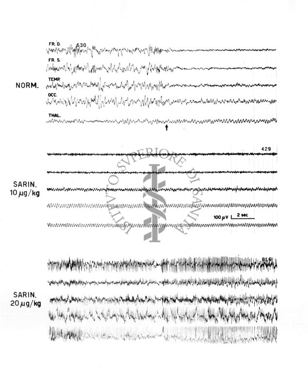 Sarin Pam - Azione elettroencefalografica