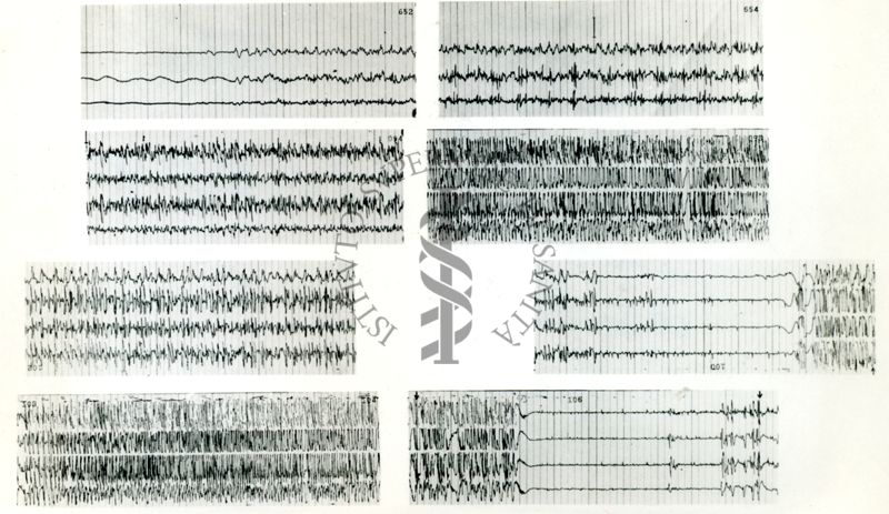 Rapporti tra circolazione cerebrale ed elettroncefalografia