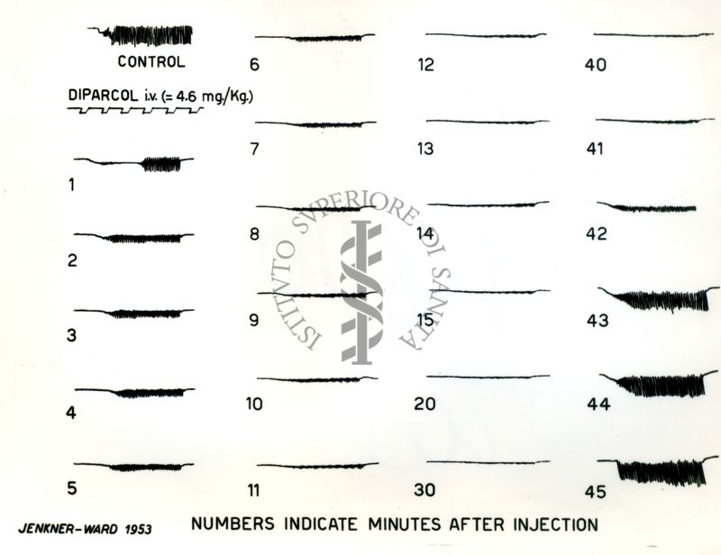 Tracciati elettromiografici