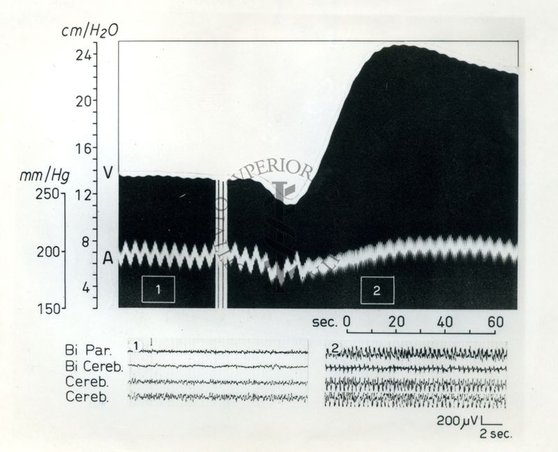 Attività elettrica cerebrale e circolazione