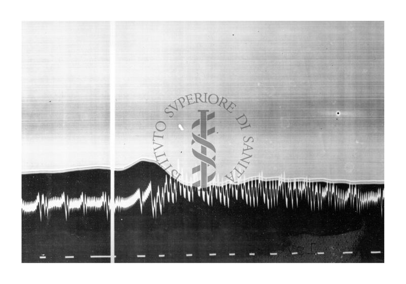 Azione vascolare cerebrale della stricnina