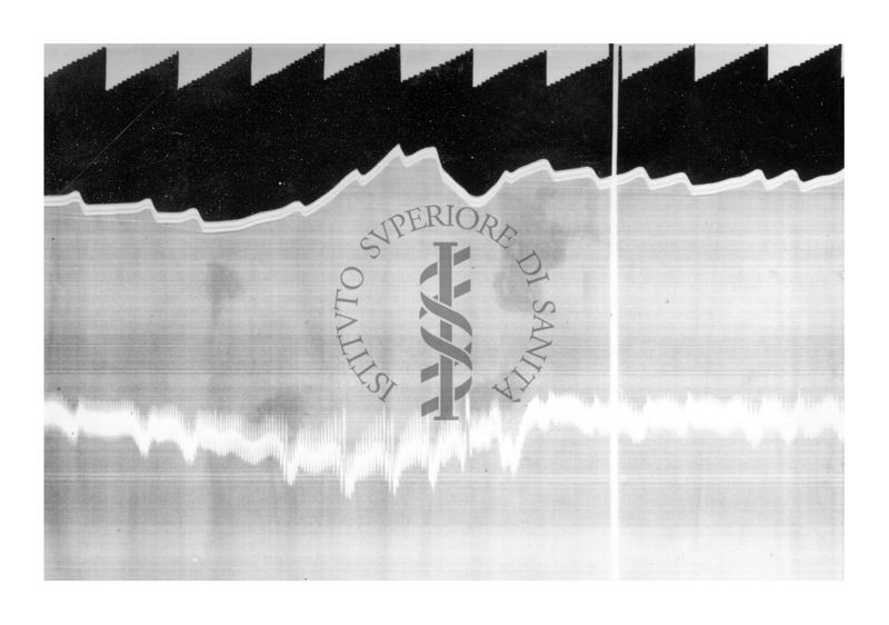 Azione vascolare cerebrale della stricnina