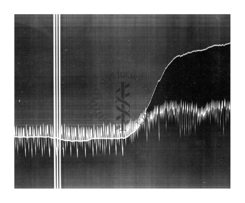 Azione vascolare cerebrale della stricnina