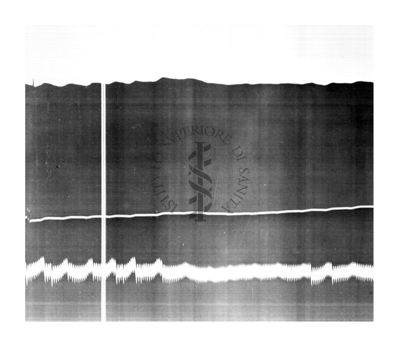 Azione vascolare cerebrale della stricnina