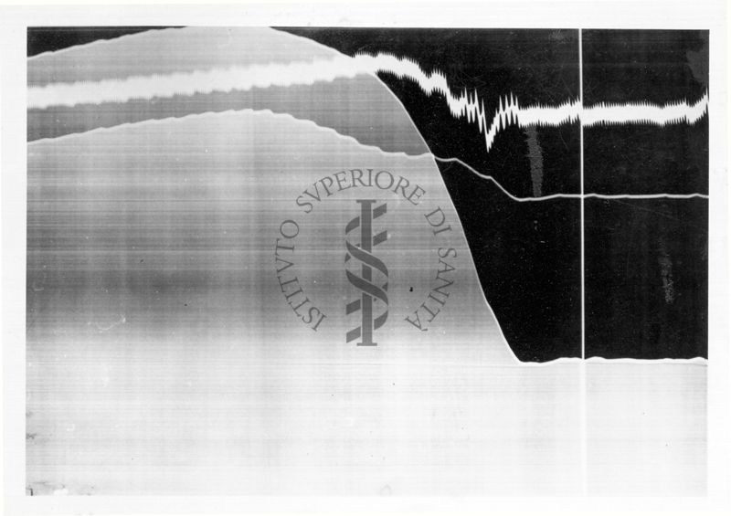 Azione vascolare cerebrale della stricnina