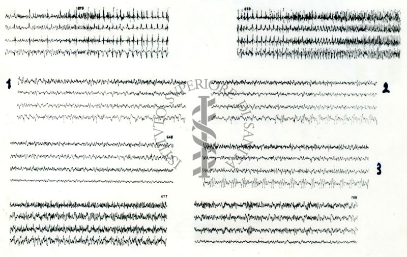 Azione elettroencefalografica della stricnina