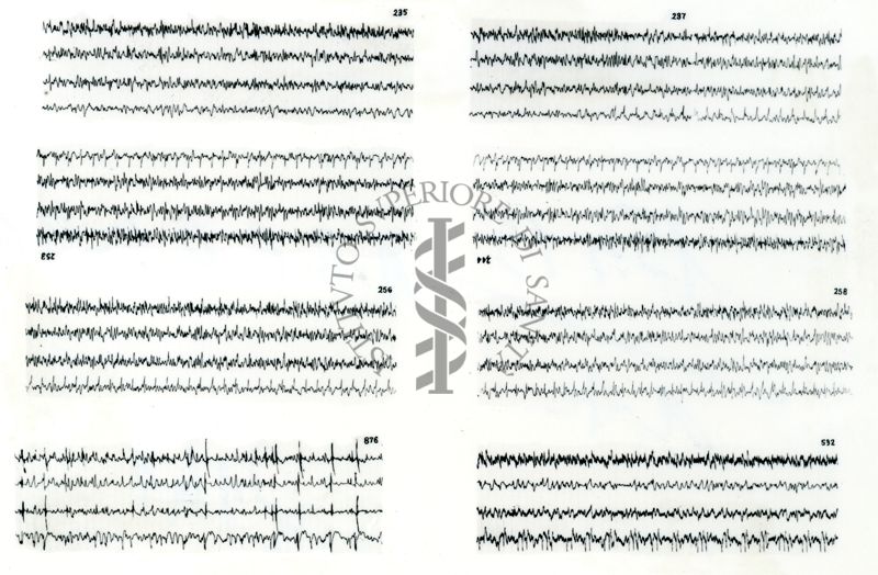 Azione elettroencefalografica della stricnina