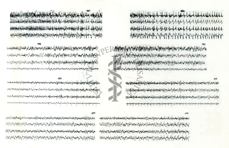 Azione elettroencefalografica della stricnina