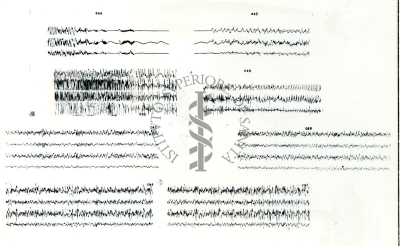 Azione elettroencefalografica della stricnina