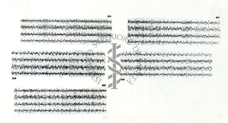 Azione elettroencefalografica della stricnina