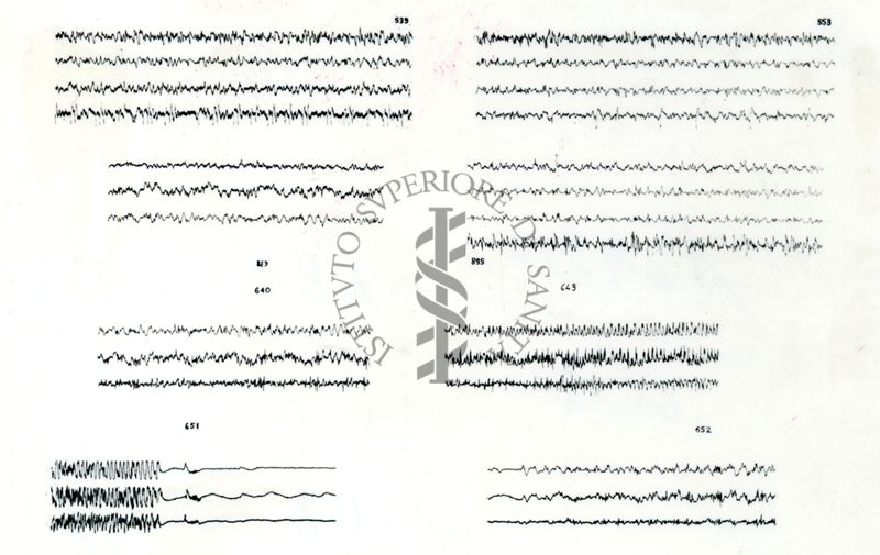 Azione elettroencefalografica della stricnina