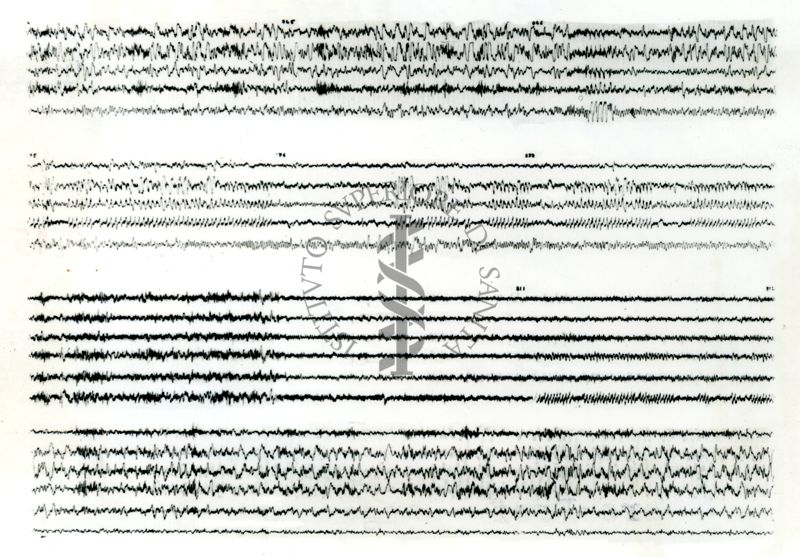 Schema di un cervello di coniglio