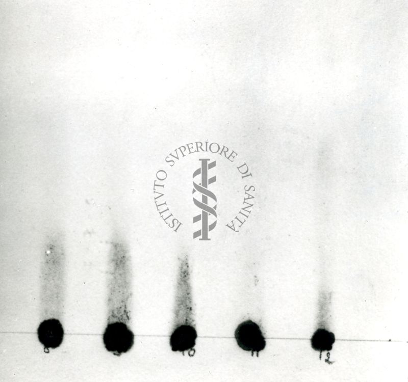 Cromatografia di acidi grassi