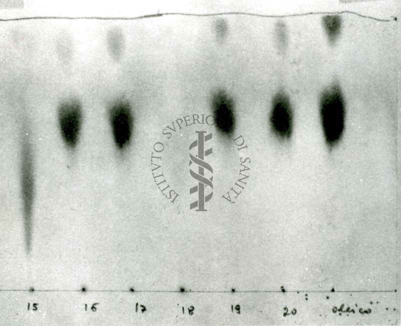 Cromatografia di acidi grassi