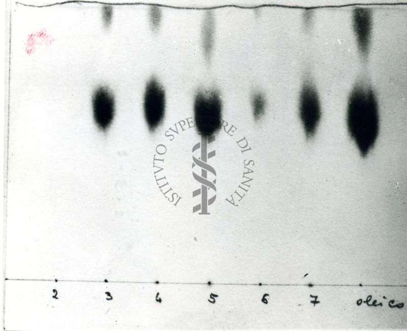 Cromatografia di acidi grassi