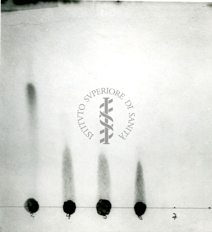 Cromatografia di acidi grassi