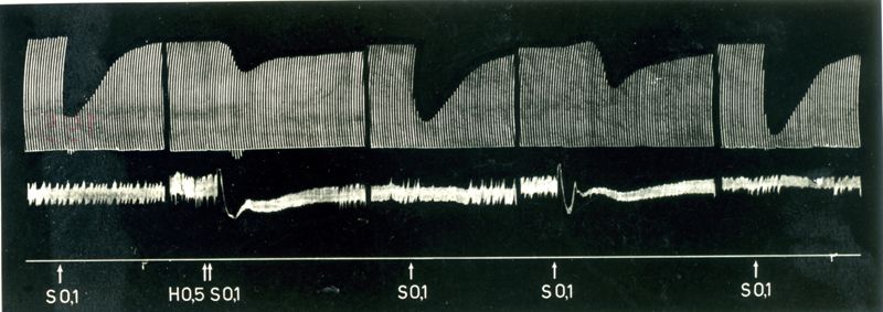 Azione dell'istamina sulla trasmissione neuromuscolare in relazione agli effetti di alcuni curari