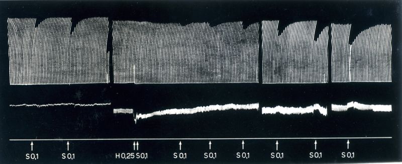 Azione dell'istamina sulla trasmissione neuromuscolare in relazione agli effetti di alcuni curari