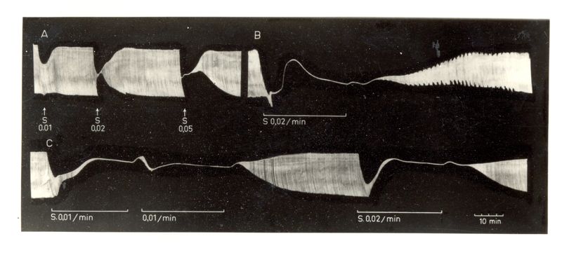 Azione di alcuni prodotti da Laboratorio sulla trasmissione neuromuscolare