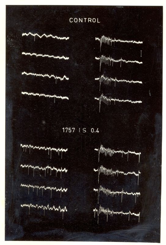 Registrazione di singole cellule a livello del midollo spinale