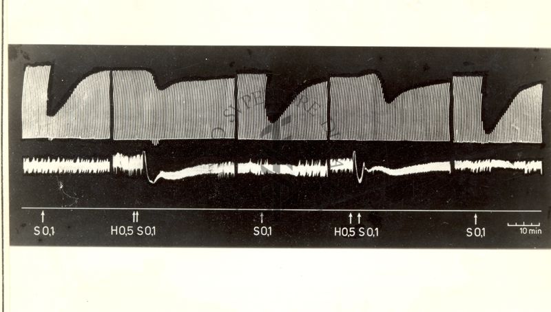 Azione delle istamine nei confronti della succinilcolina sulla trasmissione neuromuscolare