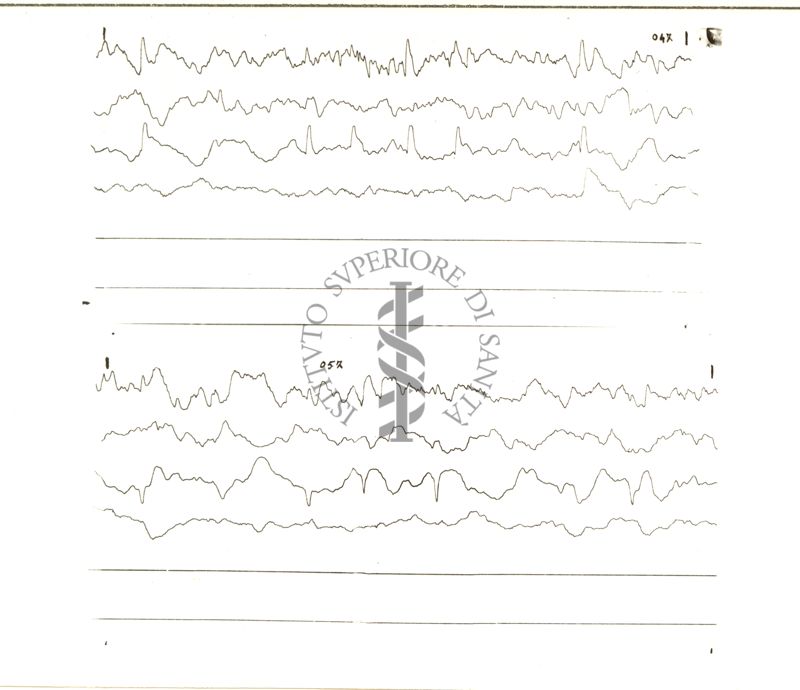 Tracciati elettroencefalografici di coniglio