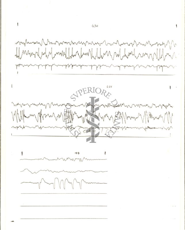 Tracciati elettroencefalografici di coniglio