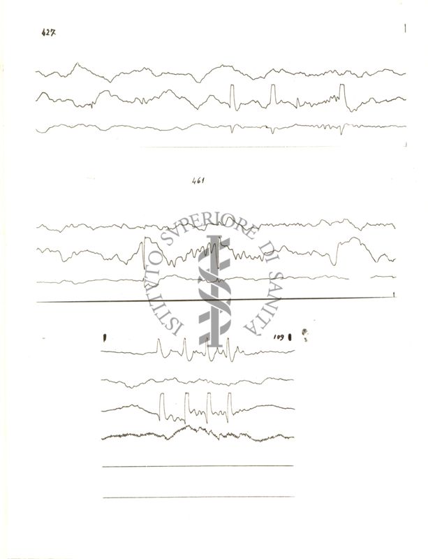 Tracciati elettroencefalografici di coniglio