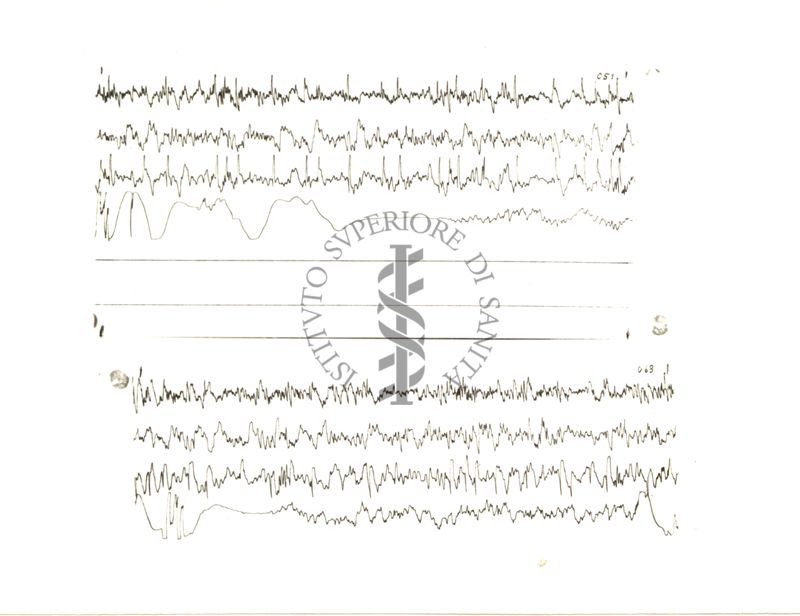 Tracciati elettroencefalografici di coniglio