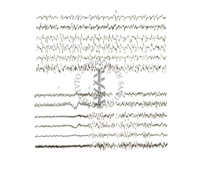 Tracciati elettroencefalografici di coniglio