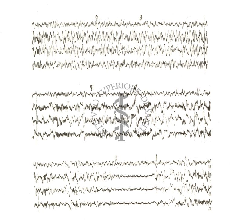 Tracciati elettroencefalografici di coniglio