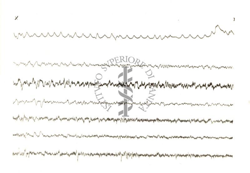 Tracciati elettroencefalografici di coniglio