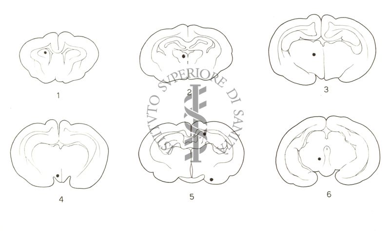 Tracciati elettroencefalografici