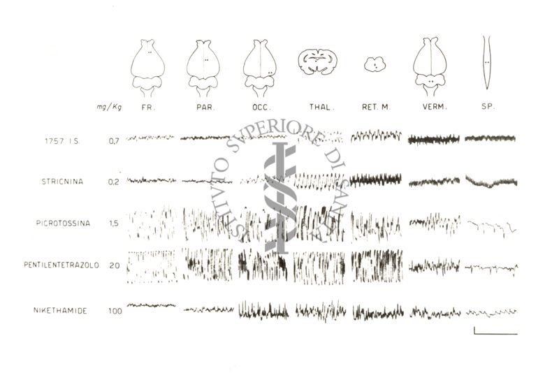 Tracciati elettroencefalografici