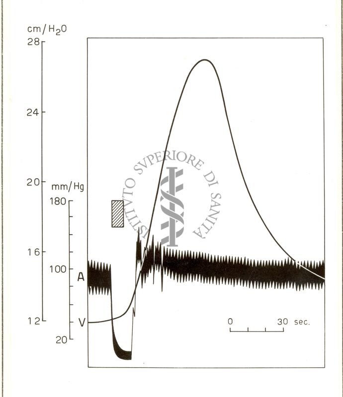 Circolazione cerebrale: indagini seriografiche