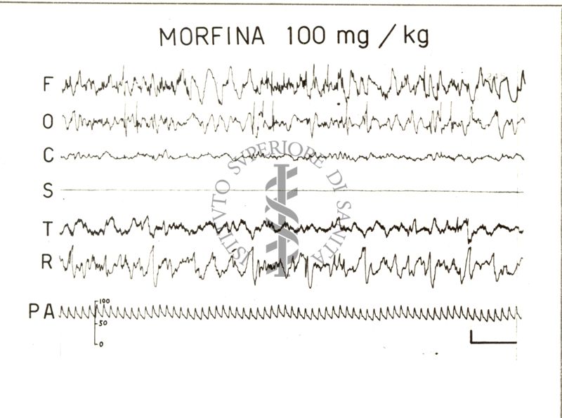 Elettroencefalogrammi di conigli