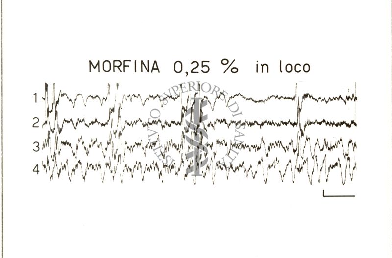 Elettroencefalogrammi di conigli