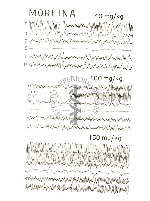 Elettroencefalogrammi di conigli