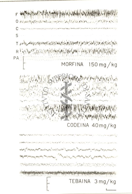 Elettroencefalogrammi di conigli