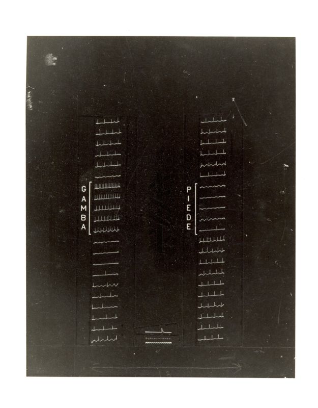 Registrazione dell'attività spontanea di singole cellule a livello del midollo spinale