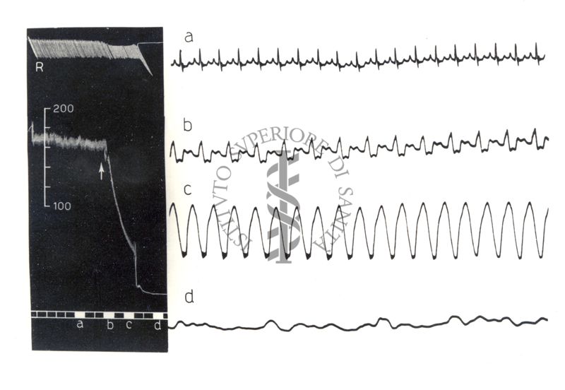 Lavoro sul 2099 I.S. - Derivato del Bispidoli Cardio Tossico