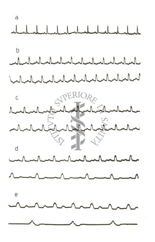 Lavoro sul 2099 I.S. - Derivato del Bispidoli Cardio Tossico