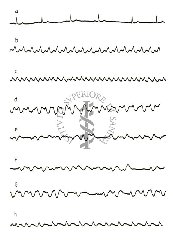 Lavoro sul 2099 I.S. - Derivato del Bispidoli Cardio Tossico