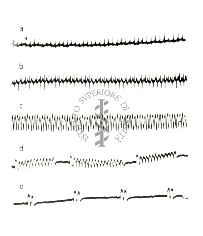 Lavoro sul 2099 I.S. - Derivato del Bispidoli Cardio Tossico