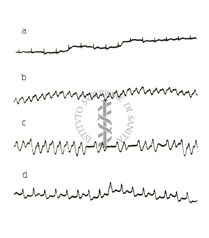 Lavoro sul 2099 I.S. - Derivato del Bispidoli Cardio Tossico