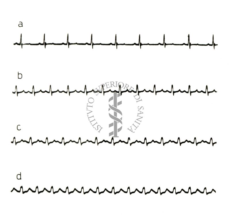 Lavoro sul 2099 I.S. - Derivato del Bispidoli Cardio Tossico